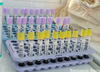 Омичи смогут бесплатно и анонимно проверить свой ВИЧ-статус Фото: Владимир Казионов
